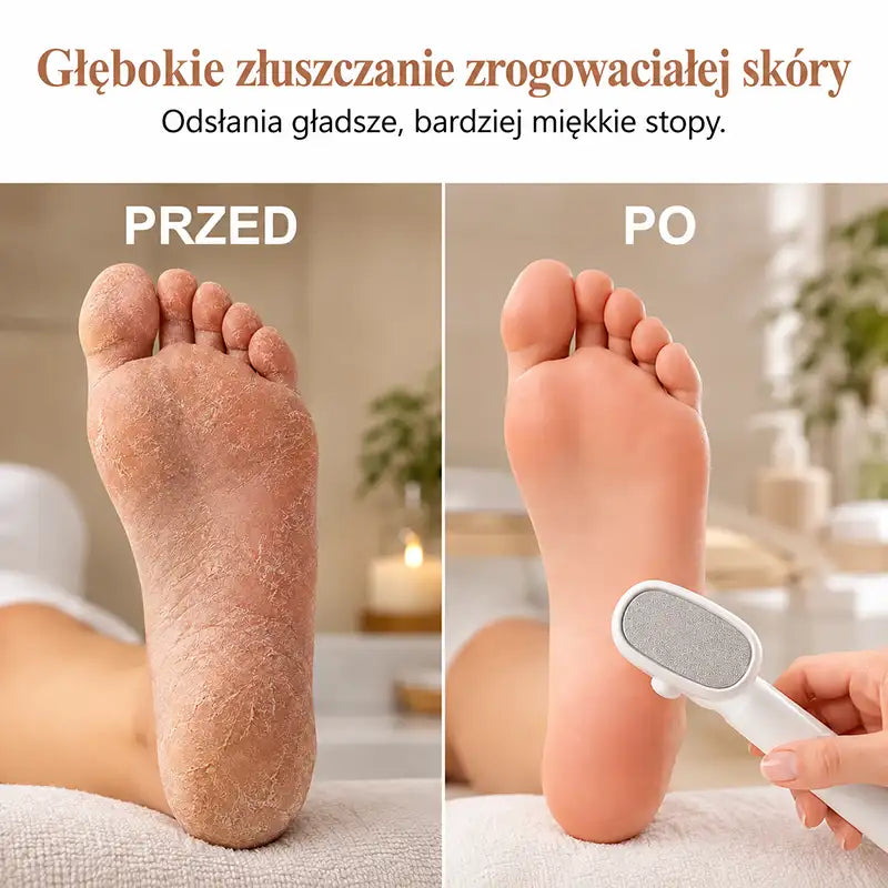 Tarka do pięt One-Pass do usuwania zrogowaceń